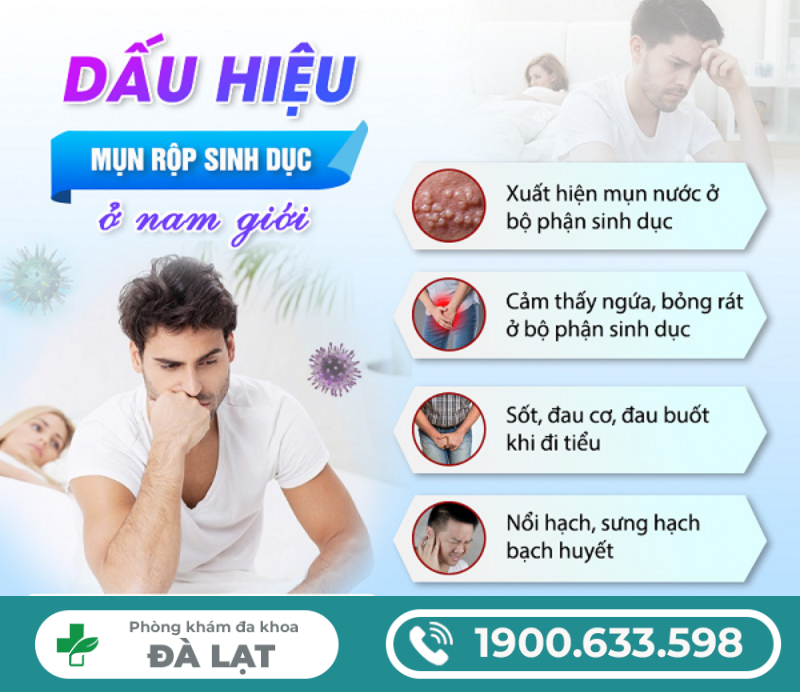 Hình ảnh minh họa